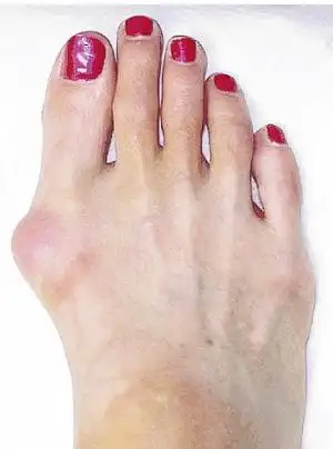 16岁,172算高吗,能穿高跟鞋吗?