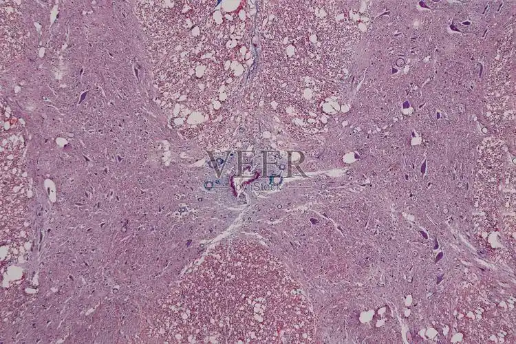 显微镜下观察脊髓的神经元细胞照片摄影图片