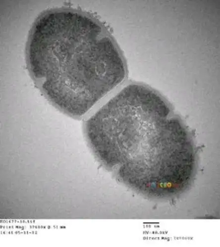 电子显微镜下的肺炎双球菌