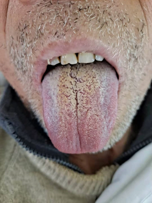 肺炎不可怕关键是要有思路和方法