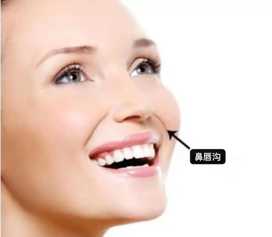 是由上唇方肌和颧骨的上颌突构成,位置在鼻翼两侧至嘴角两侧.