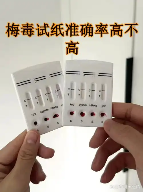 梅毒试纸准确率高不高