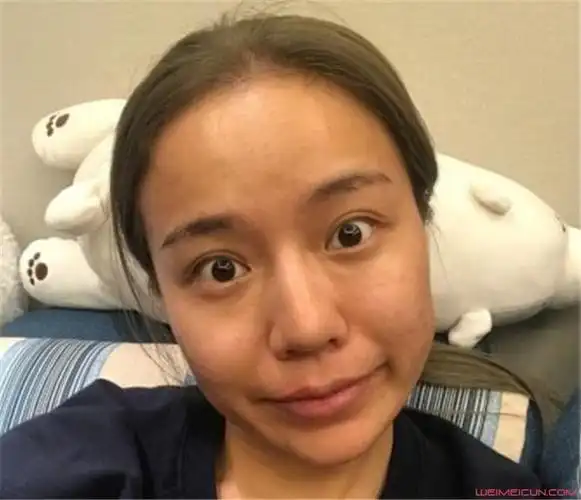 李雨桐素颜照片与高磊鑫旧照素颜对比天差地别