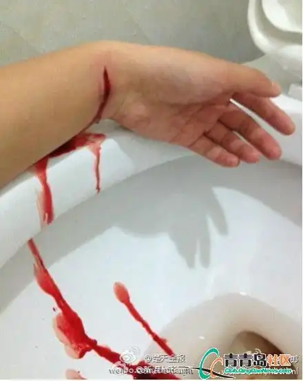 【都市快报】杭州:女生微博直播割腕 网友接力转发求救