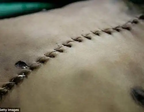 菲律宾反毒战开始后的殡仪馆