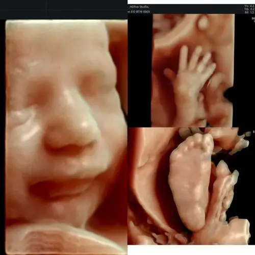 我已经是个大孩子了,32周,妈妈再坚持坚持,就可以看到我,抱抱我了,我