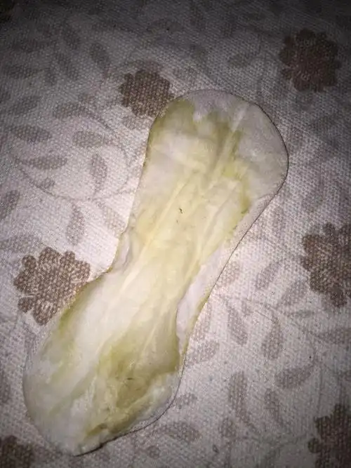 就白带多.有点异味 但是刚流出来是没有味道的.内裤刚换上有时候湿的