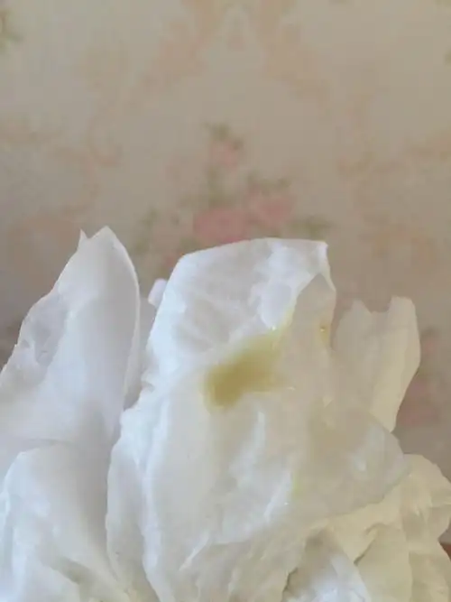 宝宝感冒咳嗽吃药后吐奶带这种发黄又有点发黑的痰,请问严重吗?