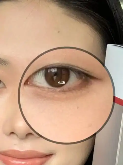 我到底属于什么眼型圆眼细长眼