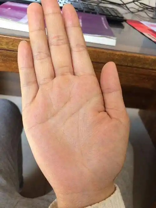 俗语说:"断掌一条线,富贵不相欠"有没有道理?很多人深信不疑