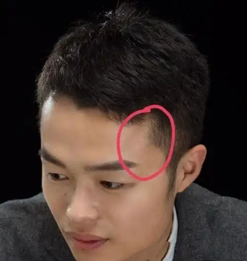 这几个长痣的人,富贵难逃.