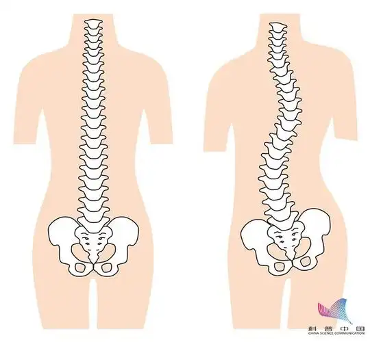 正常的脊柱有良好的生理弧度,周围的肌肉和韧带附着在脊柱上,各自发挥