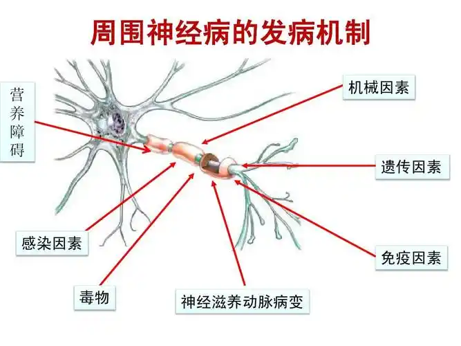 周围神经病诊治蒲传强ppt