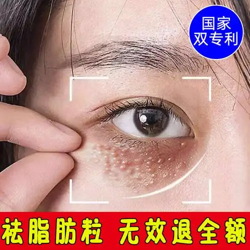 共397 件消除脂肪粒相关商品