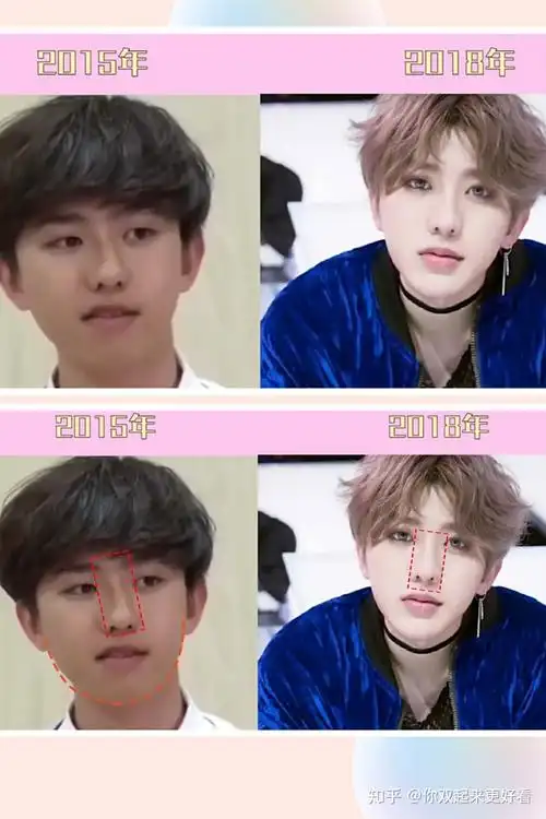 蔡徐坤的眼睛,鼻子,下巴都动过~由此也可以看出来坤坤真的是长了一张