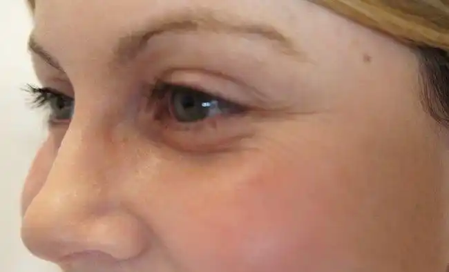 女人长皱纹就去打玻尿酸? 抹点厨房便宜货, 不足半月烫平皱纹