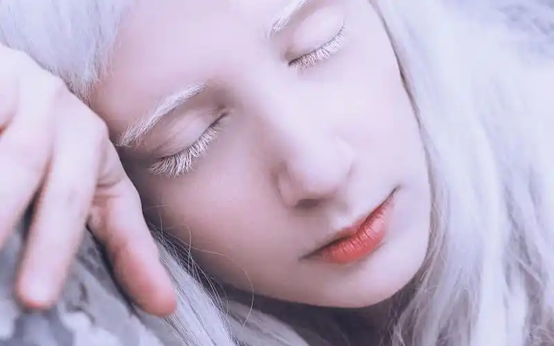 白化病女孩们 | 3032 3635363132 3631 3735