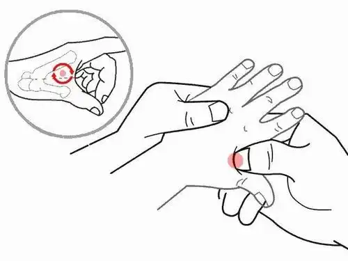 小儿推拿小儿扁桃体炎不可轻视