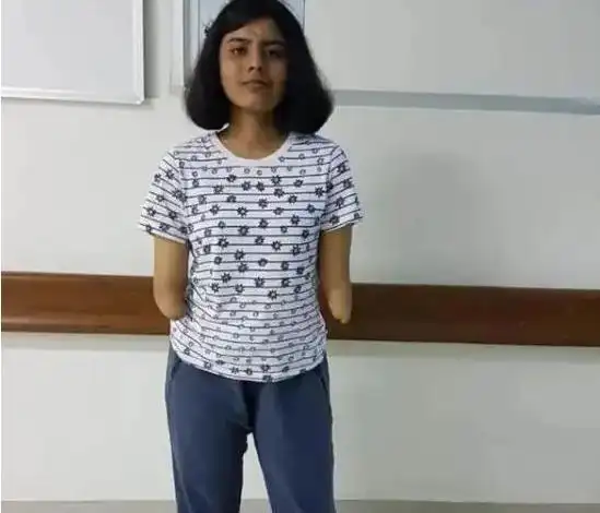 印度女孩因车祸双手截肢移植黑人手臂后肤色开始变黑