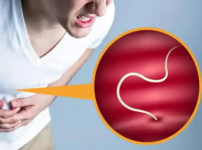患了蛔虫病的人主要症状就是肚子痛和莫名的肚胀感,这是由于蛔虫成虫