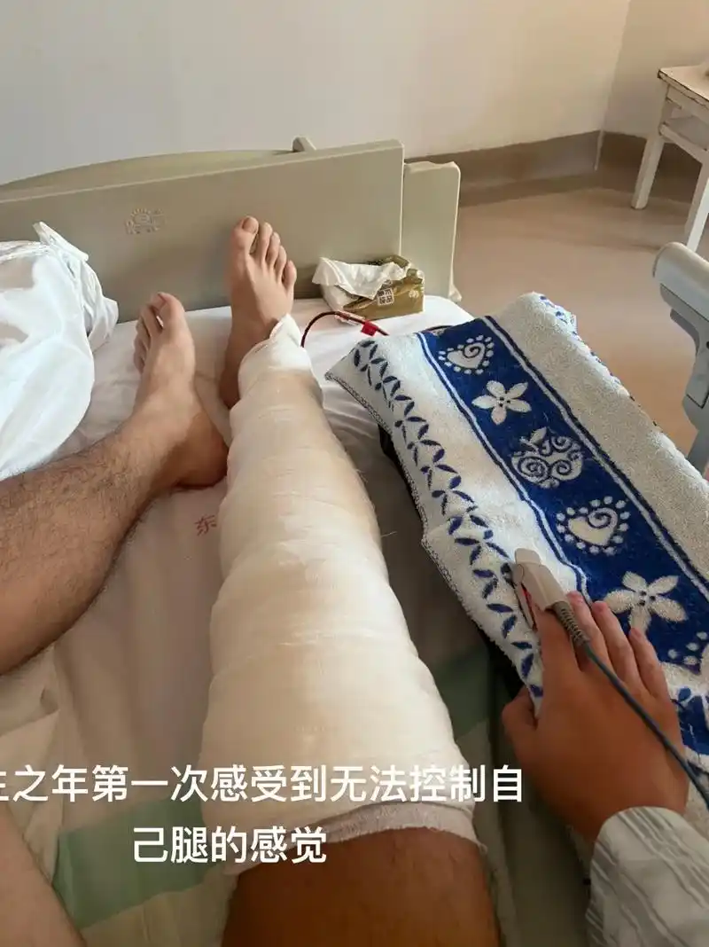 前交叉韧带断裂,半月板三级撕裂.