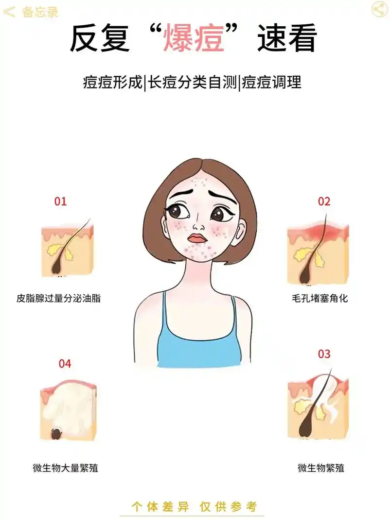 解锁痘痘形成机制看看你长的是哪种痘痘