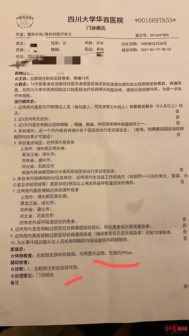 华西医院出具的门诊病历.