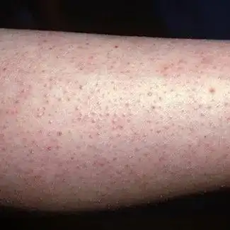 妈耶黑胳膊糙腿儿有救了