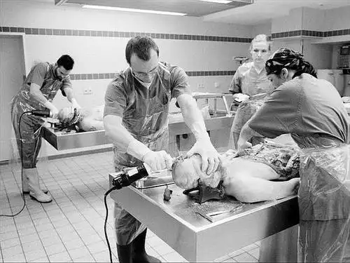 sweetiepizza的相册-揭秘真实法医解剖室zz