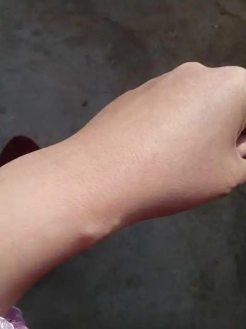 宝妈们看看这是骨刺么?