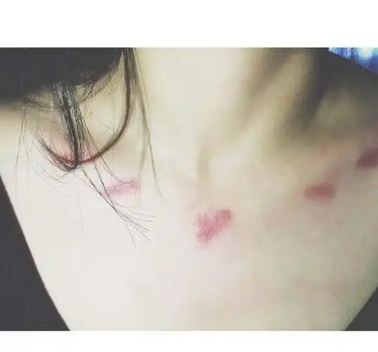 而且力道稍微大一些,还会从脖子上留下一些草莓印,情侣在接吻的时候在