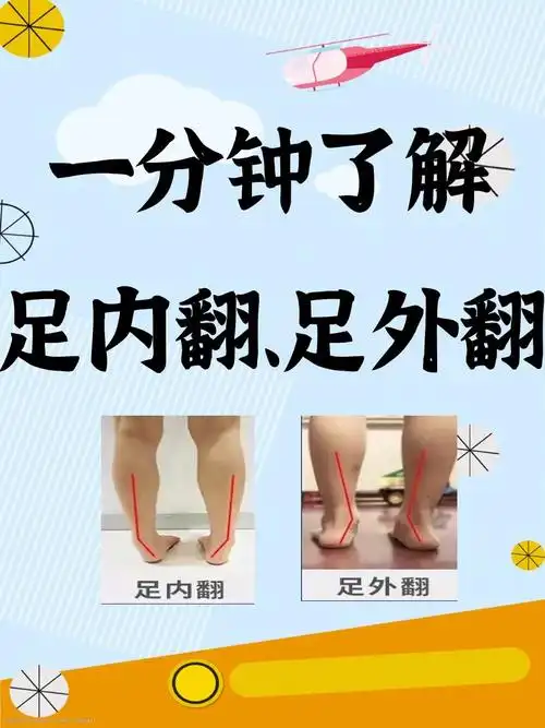 宝妈必看60一分钟了解足内翻足外翻60