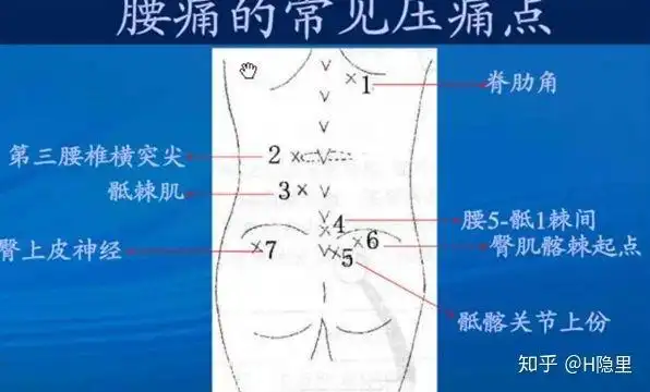 孕妈妈们看过来关于产后腰背痛我觉得你们应该看看这篇文章