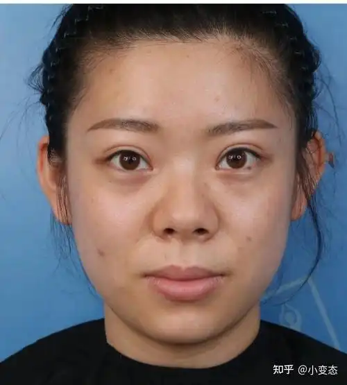 别当韭菜被人割来看看靠谱功课北京有没有隆鼻做得好的医生