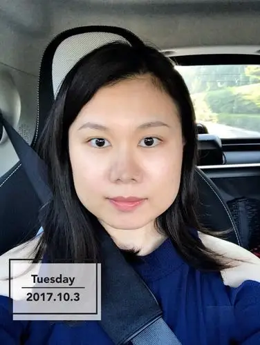 瘦脸针|能拯救大多数巨大腮帮子一直以来,我都以为除_圈子-新氧美容