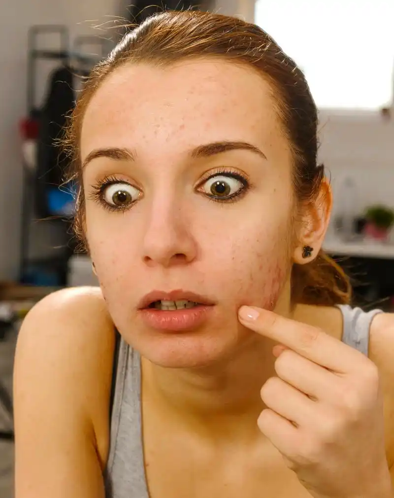 脸色发黄暗沉长斑怎么调理?  如果你的脸色发黄暗沉并出现斑点,可以尝