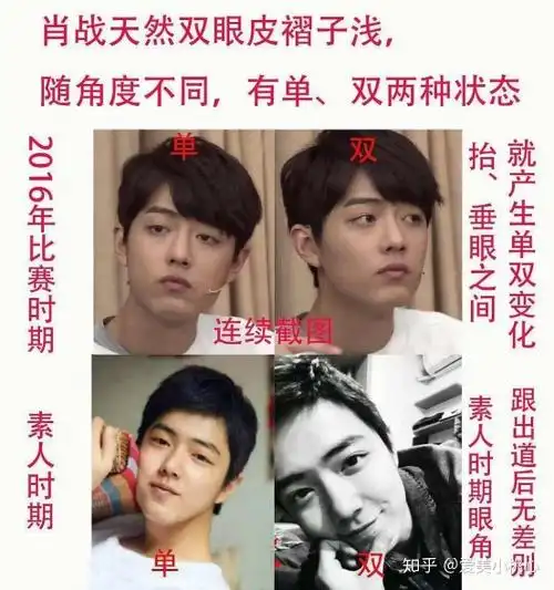 肖战是真的没整容 - 知乎