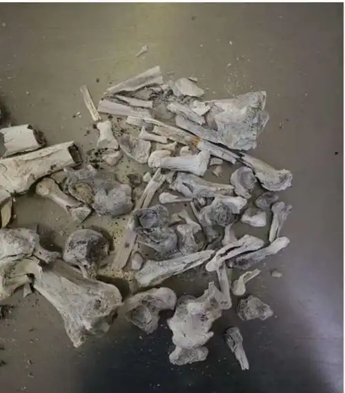 图为糖尿病人的骨灰,特点是发灰或暗黑,主要表现在下肢骨较为明显