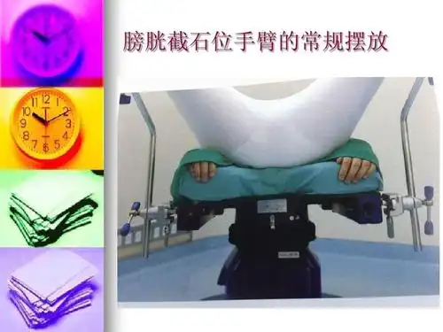 膀胱截石位手臂的常规摆放