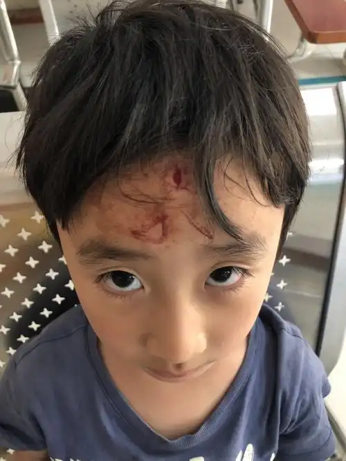 孩子受伤别先着急着追究责任