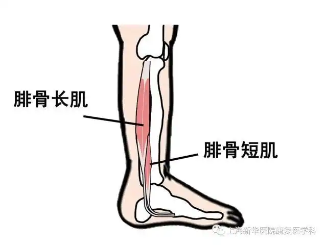 只改善肌肉的酸胀只是治标不治本,所以最后也是最重要的一点,我们需要