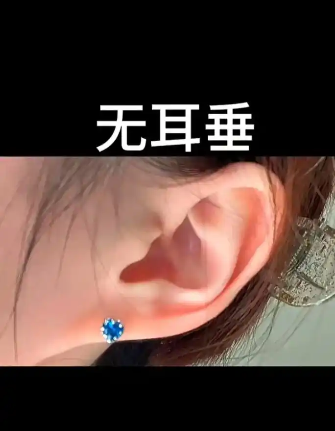 你们知道什么叫鸡嘴耳嘛? 顾名思义就是94的嘴巴一样的耳朵, - 抖音