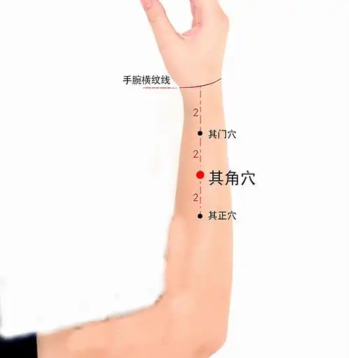 3,针其门穴,其角穴,其正穴,有效.2,针下三皇穴,通肾穴,通背穴,有效.