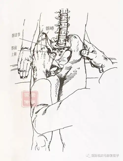 图1- 髂嵴触诊手法