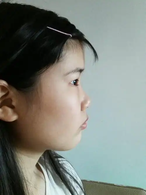 我160cm,57kg.感觉颧骨有点外扩但是因为肉多还包得住.