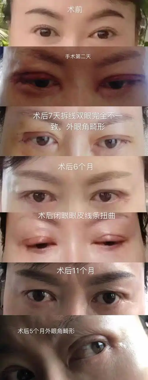 7女子起诉称整容失败一审判涉事机构欺诈应赔偿3倍整容费