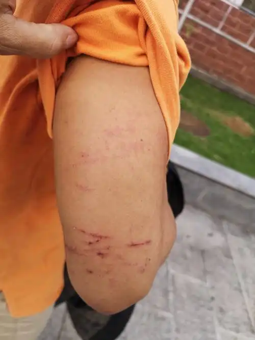 可恶!潭门合水水库承包商雇多员打手群殴当地无辜农民