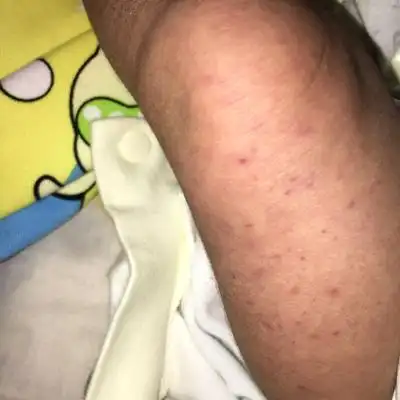 问答 婴儿期0-1岁         推荐回答     关於宝宝36天就左腿上突然起