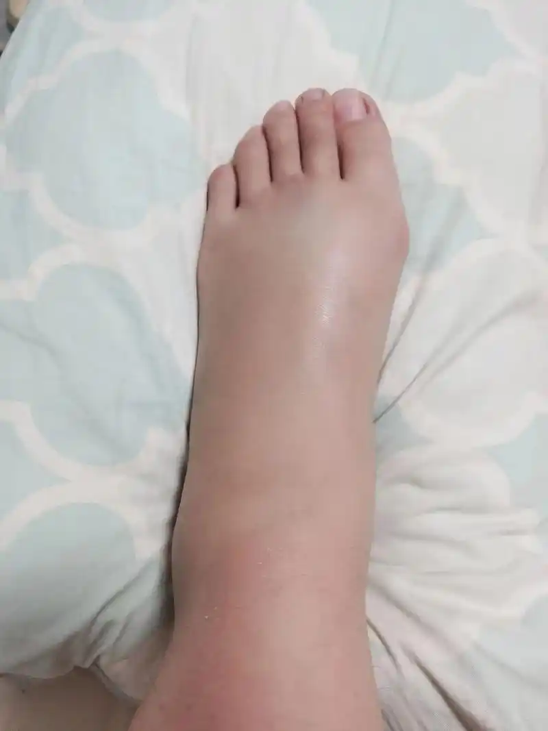 不一样的脚丫子 它还在它还在😱 😓#彩虹色脚丫🌈