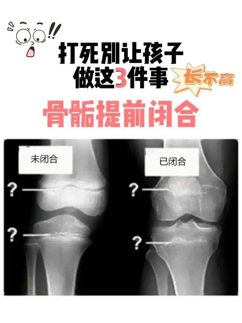 千万别让孩子做这3件事,小心骨骺线闭合.骨骺线一旦闭合,孩子 - 抖音